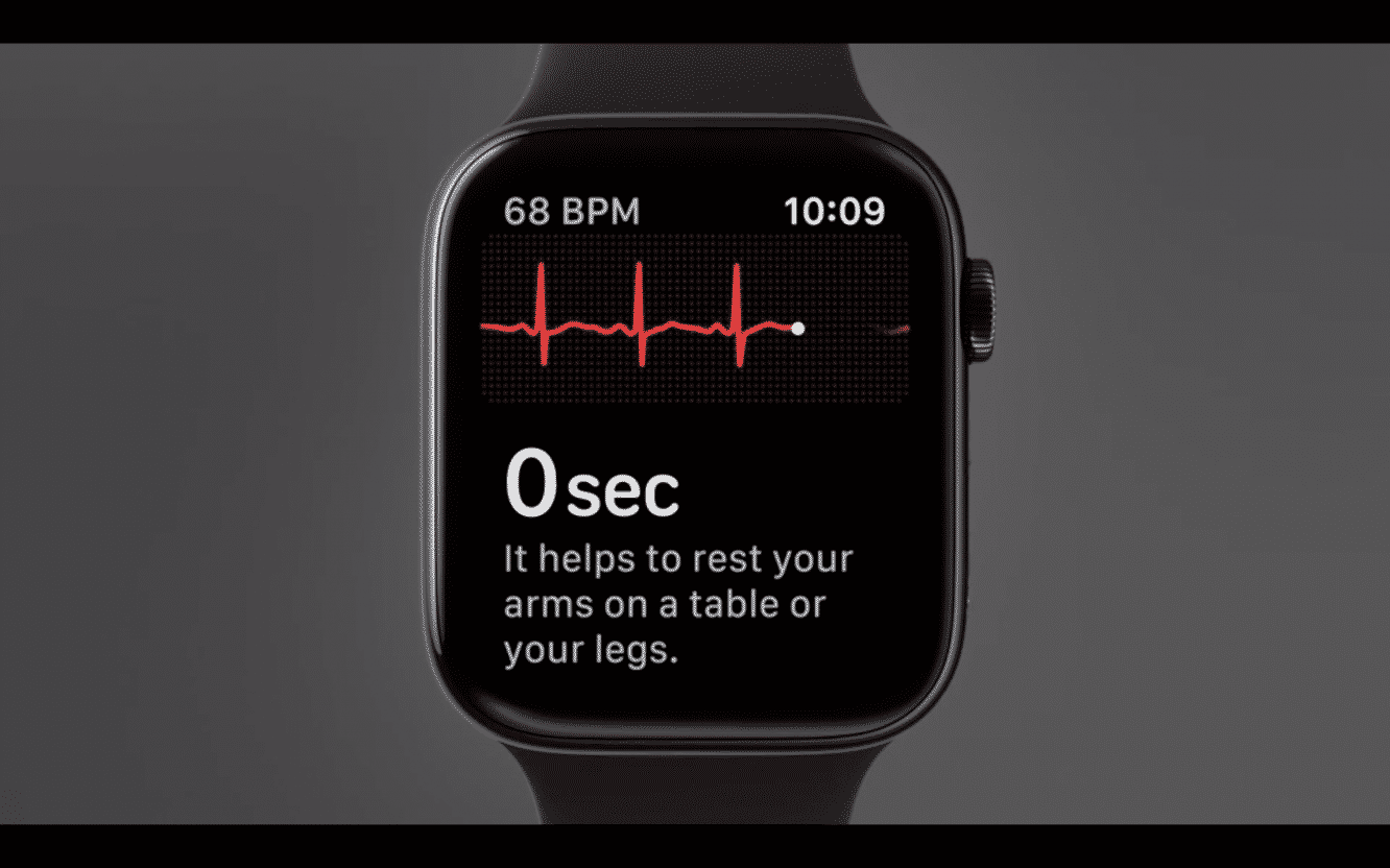 Apple Watch ECG technology is useful but “very rudimentary”