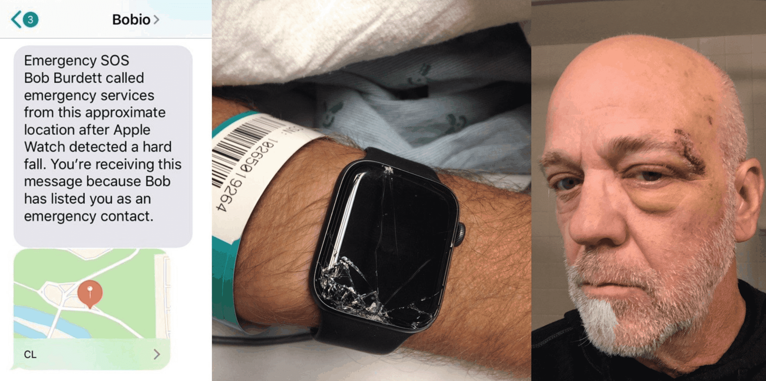 Apple Watch Credited in Saving Mountain Biker After Experiencing Fall