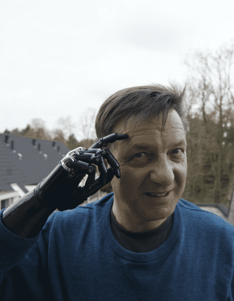 Transhumanism: How Close Are We To Becoming Cyborgs?